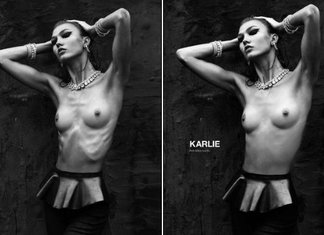 Moda e anoressia: quando è troppo? Moda Anoressia Fenomeno Sociale Esagerazione Modelle Scheletriche Karlie Kloss