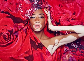La storia di Winnie Harlow, modella con la vitiligine Winnie Harlow 2015 Campaign Desigual Primavera Estate
