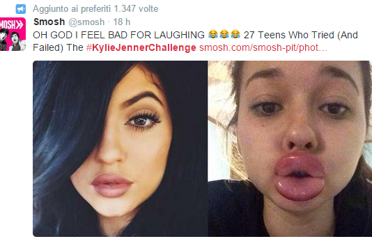 #kyliejennerchallenge, il gioco pericoloso impazza tra le adolescenti